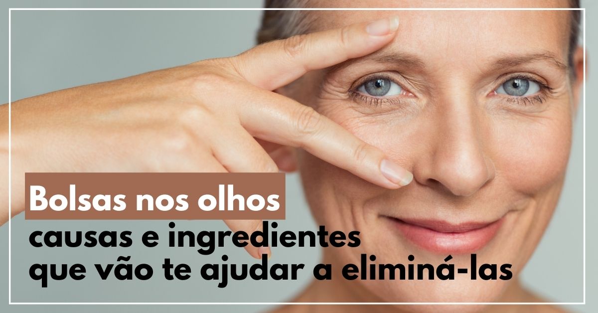 Bolsas de los ojos: causas e ingredientes que ayudan a eliminarlas